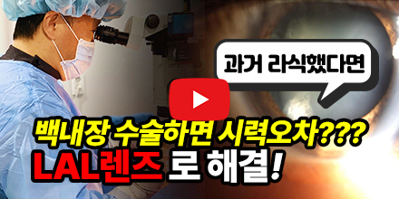 lal백내장수술