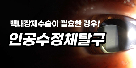 lal백내장수술